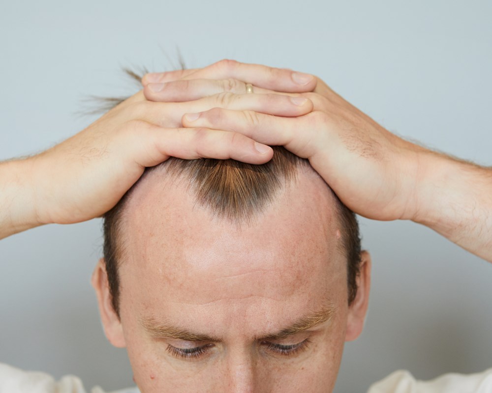 Masterklinikken Viker Haar